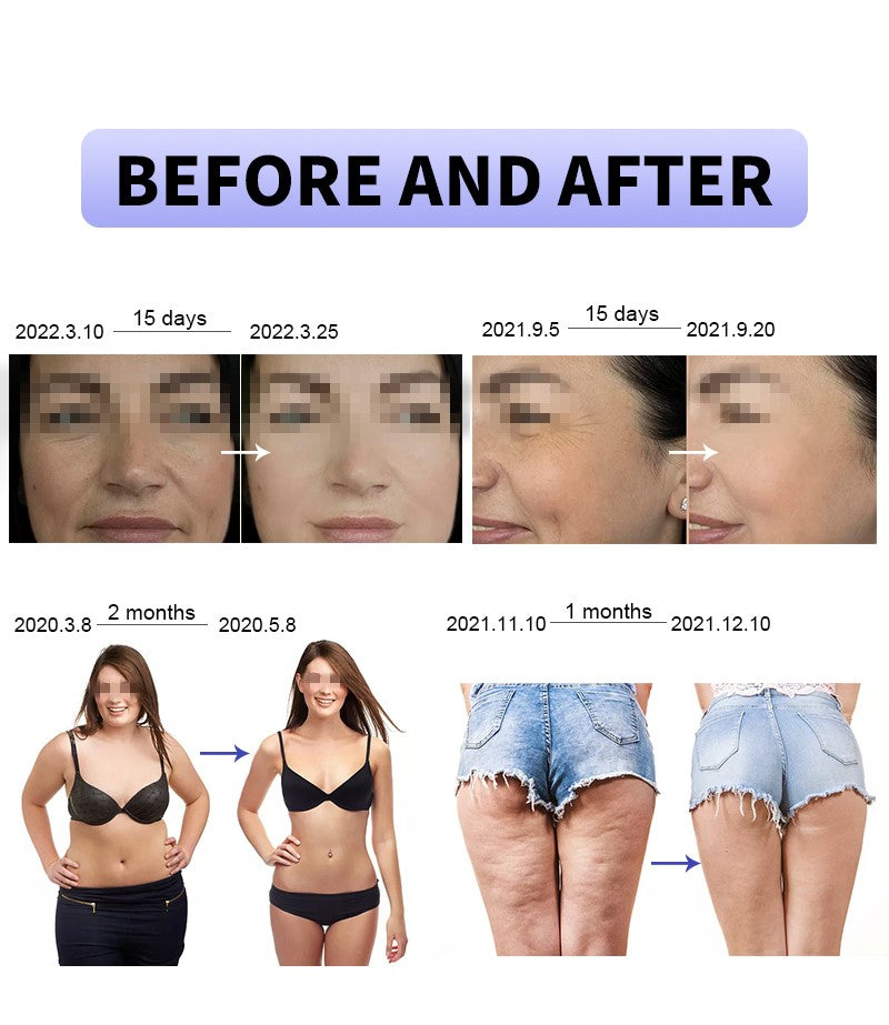 CAVITATION MACHINE