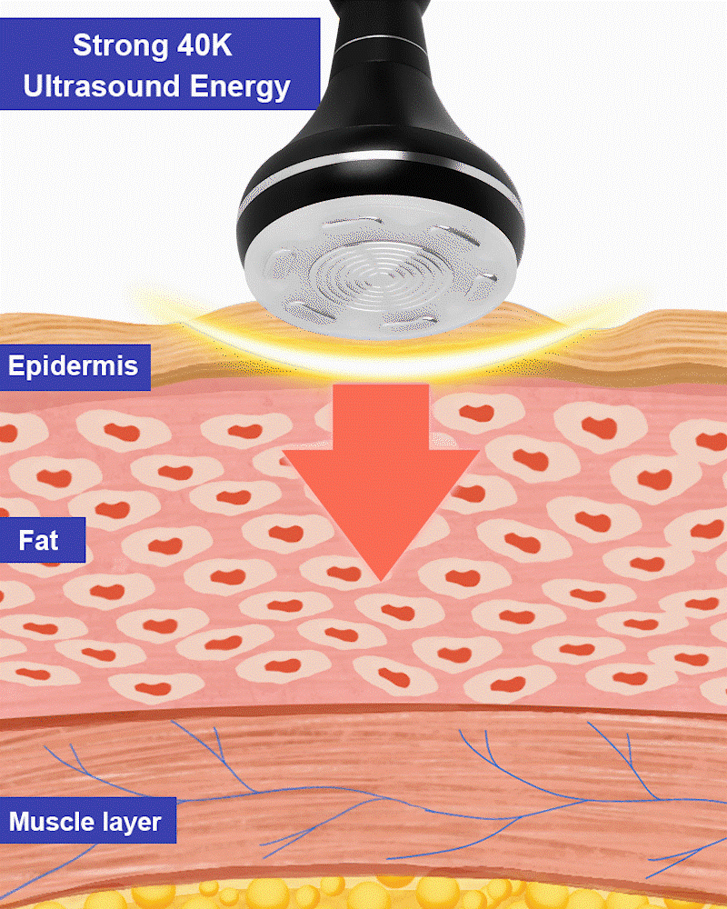 CAVITATION MACHINE